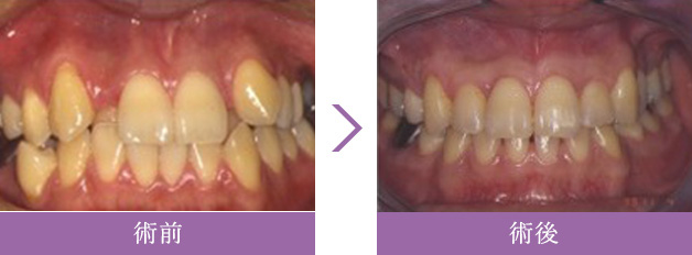 矯正歯科治療症例